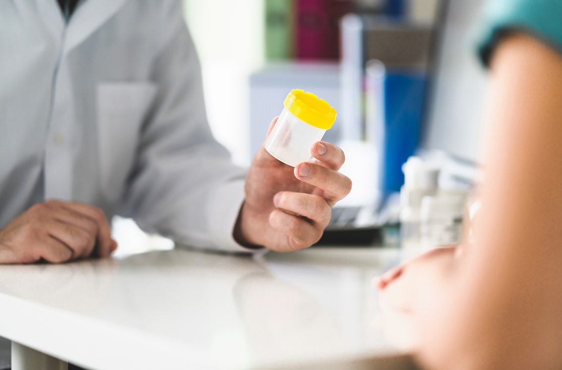 Remise d’un flacon de prélèvement urinaire dans un laboratoire médical pour un dépistage toxicologique en cas de suspicion de soumission chimique.