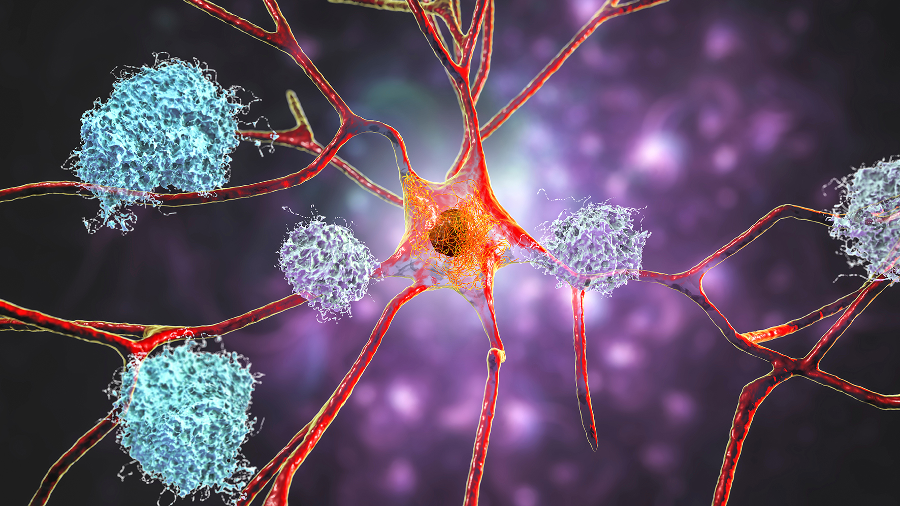 Inovie contribue au diagnostic précoce de la maladie d’Alzheimer grâce aux biomarqueurs sanguins comme la pTau217.